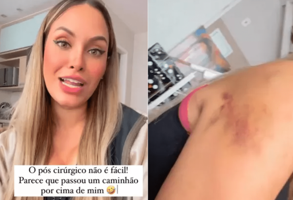 Sarah Andrade fala sobre cirurgia (Foto: Reprodução)