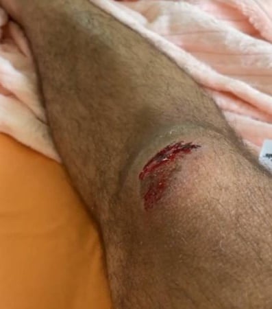 Gil do Vigor sofre acidente de bicicleta e publica foto ensanguentado (Reprodução/Instagram)