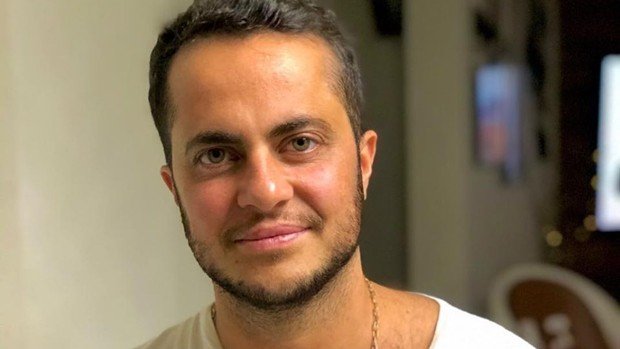 Thammy Miranda faz transplante capilar e exibe resultado na web