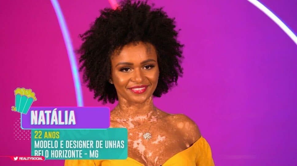 BBB22: Natália é modelo e enfrenta o vitiligo desde muito nova
