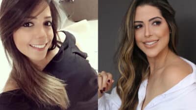 Imagem do post BBB22: Laís se revolta com fotos antes e depois de harmonização facial: “Vergonha nenhuma”