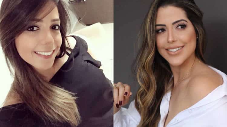 BBB22: Laís se revolta com fotos antes e depois de harmonização facial (Reprodução)