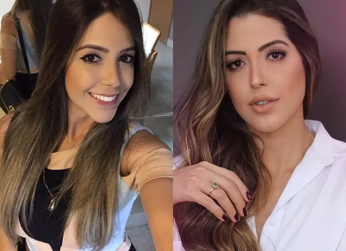 BBB22: Laís se revolta com fotos antes e depois de harmonização facial (Reprodução)