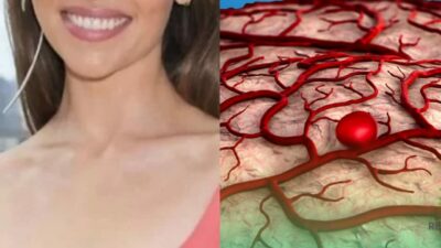 Famosa atriz escancara sofrimento após aneurismas (Foto: Reprodução/Montagem)