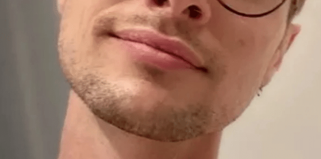 Famoso confessa que pegou HIV aos 16 anos quando perdeu a virgindade (Foto: Reprodução)