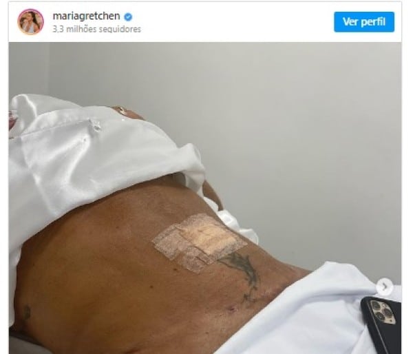 Gretchen mostra resultado de lipoaspiração em alta definição (Foto: Reprodução/Instagram)