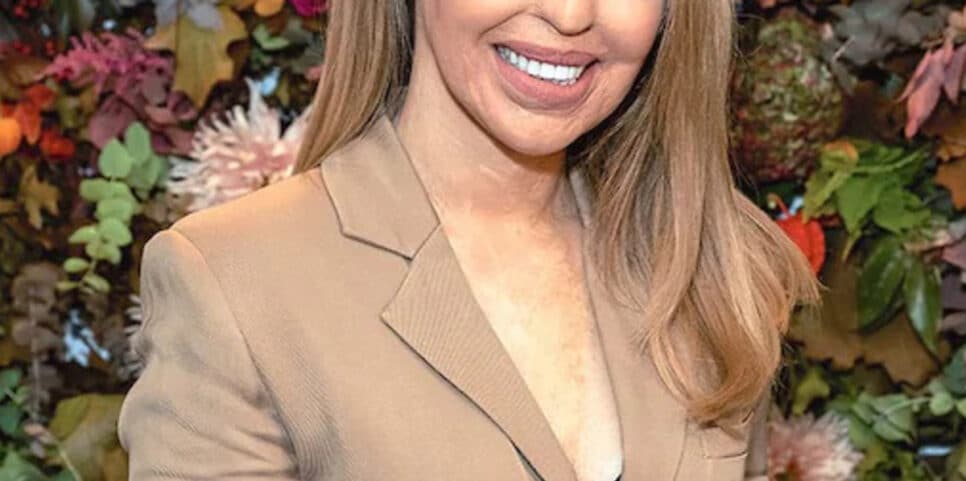 Apresentadora famosa tem rosto atacado ( Foto Reprodução)