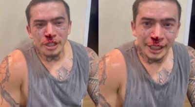 Imagem do post Whindersson Nunes aparece com o rosto cheio de sangue e preocupa os fãs: “Mexi com o cara errado”