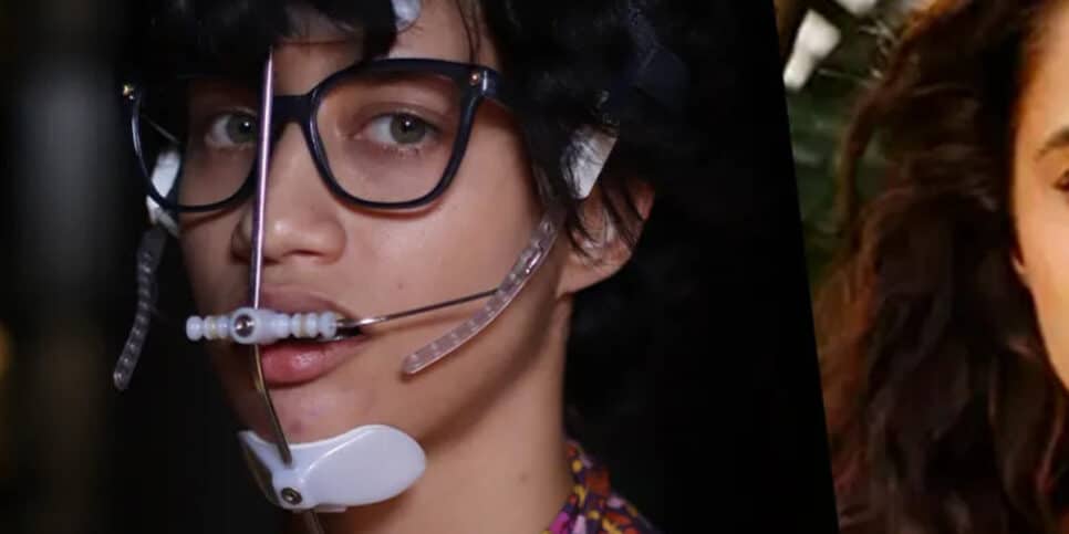 Atriz da Globo, que era cheia de aparelhos, impressiona por beleza (Foto Reprodução/Montagem/Aaron Tv))