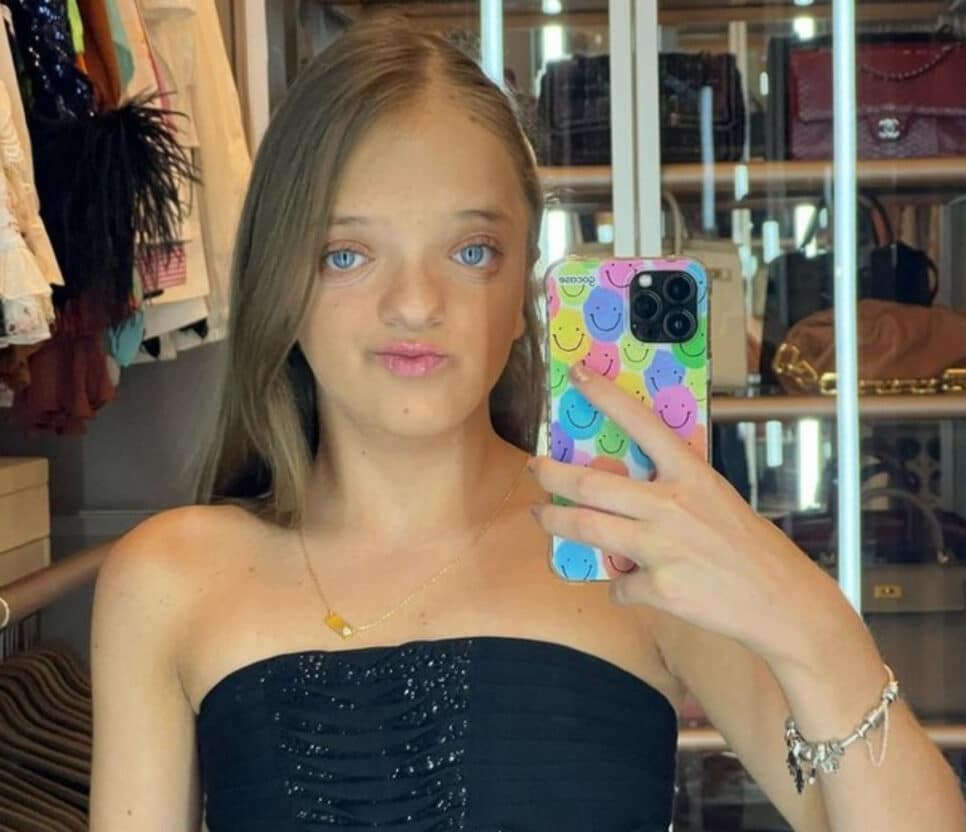 Filha de Justus e Ticiane Pinheiro, Rafinha Justus mostrou transformação que aconteceu em seu rosto e encantou a todos (Foto: Reprodução / Instagram)