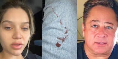 Sobrinha de Leonardo, sofreU acidente e surgiu ensanguentada com fratura: 'Desesperada