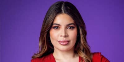 Gkay tira preenchimento e exibe antes e depois na web Foto: Reprodução