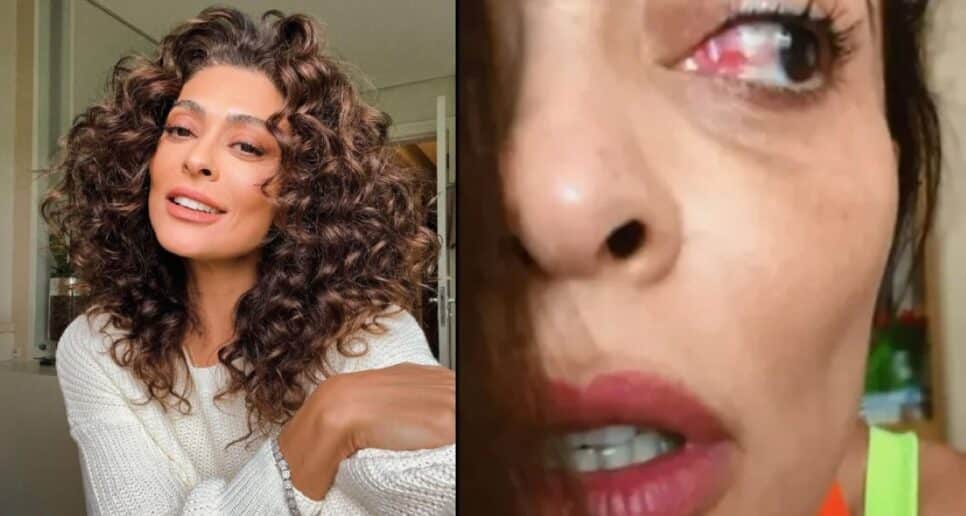 Juliana Paes lamenta após seu olho ficar vermelho (Foto: Reprodução)