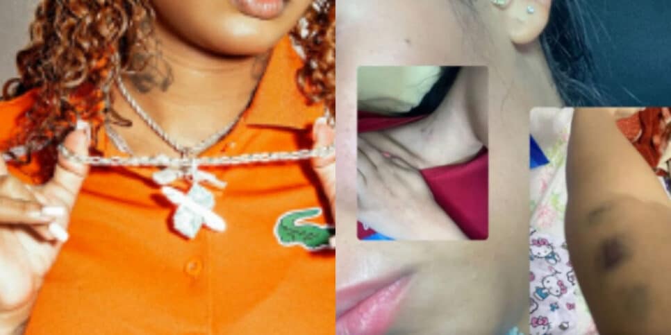 Famosa cantora é denunciada e têm agressões conta ex expostas (Foto: Reprodução)