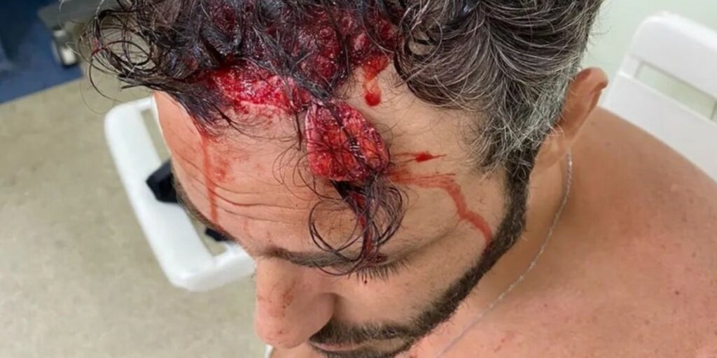 Thiago Rodrigues foi brutalmente agredido por criminosos (Foto: Reprodução)