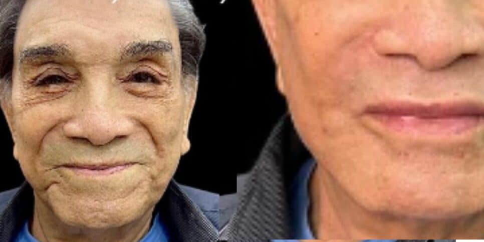 Dedé Santana, de Os Trapalhões, faz harmonização facial, resultado é surpreendente e web reage: "Chocado" - (Foto: Reprodução/Redes Sociais)