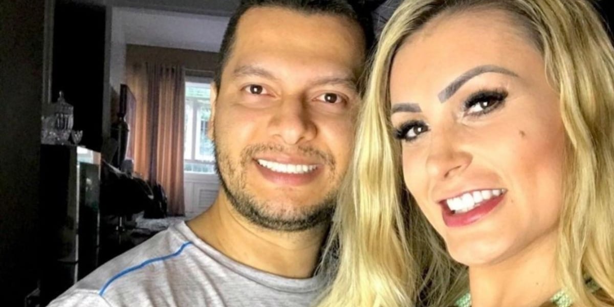 Andressa Urach faz procedimento estético e ex-marido detona (Imagem Reprodução Internet)