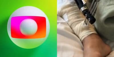 Ator teve a perna necrosada após cirurgia depois de acidente (Imagem: Montagem/Aaron Tura TV)