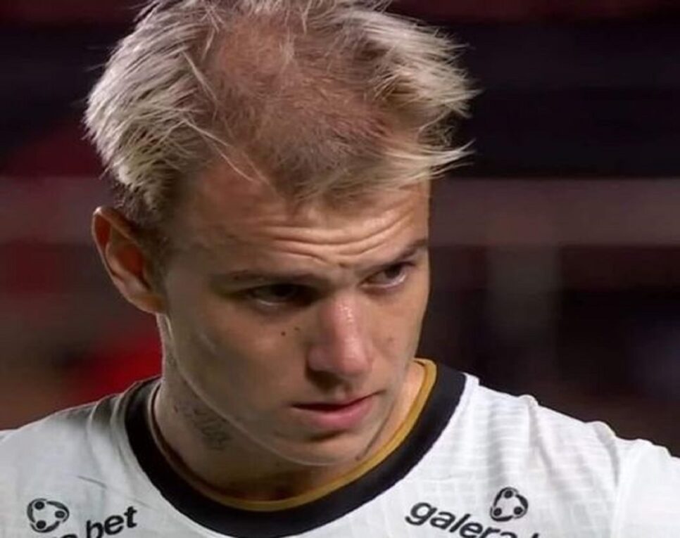 Calvície perda de cabelo Jogador Róger Guedes (Foto: Reprodução)