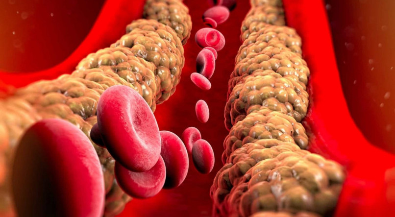 Saiba o que você deve consumir em maior quantidade para te ajudar na luta contra o colesterol alto (Foto: Reprodução/Internet)