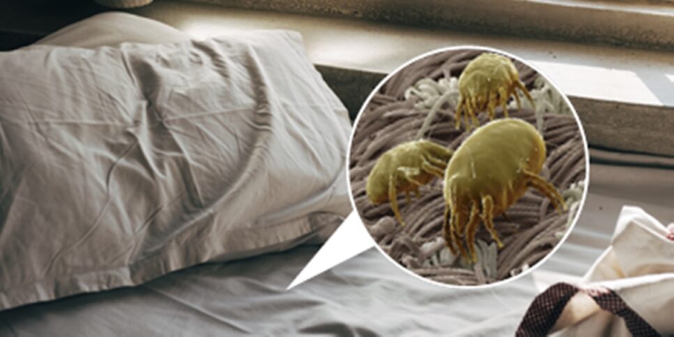 Quarto Arrumar a cama manhã Ácaros são seres microscópicos que não são vistos a olho nu, presentes na sua cama quente e úmida (Foto: Reprodução/ Internet/ Montagem)