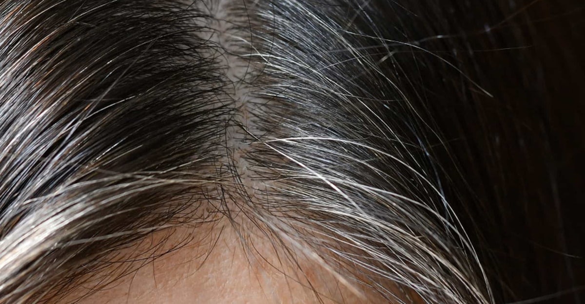 Chega de cabelo grisalho com essa mistura caseira (Foto: Reprodução/ FreePik)