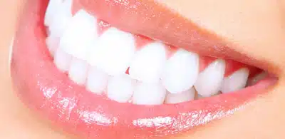 Imagem do post As 5 fórmulas naturais para CLAREAR OS DENTES e obter sempre um sorriso LINDO