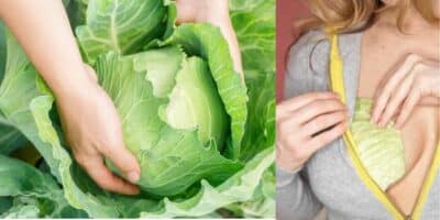 Mulher colocando folhas de repolho nos seios (Foto: Reprodução / Pinterest / Montagem HoraDoBenefício)