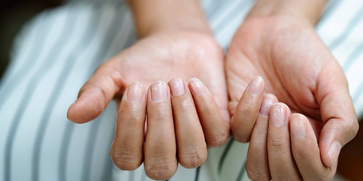 Segredo para acabar com as unhas fracas e quebradiças e deixa-las fortes e brilhantes (Imagem Reprodução Canva)