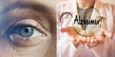 Imagem do post Atenção: Estudo revela que os primeiros sinais de Alzheimer surgem nos olhos