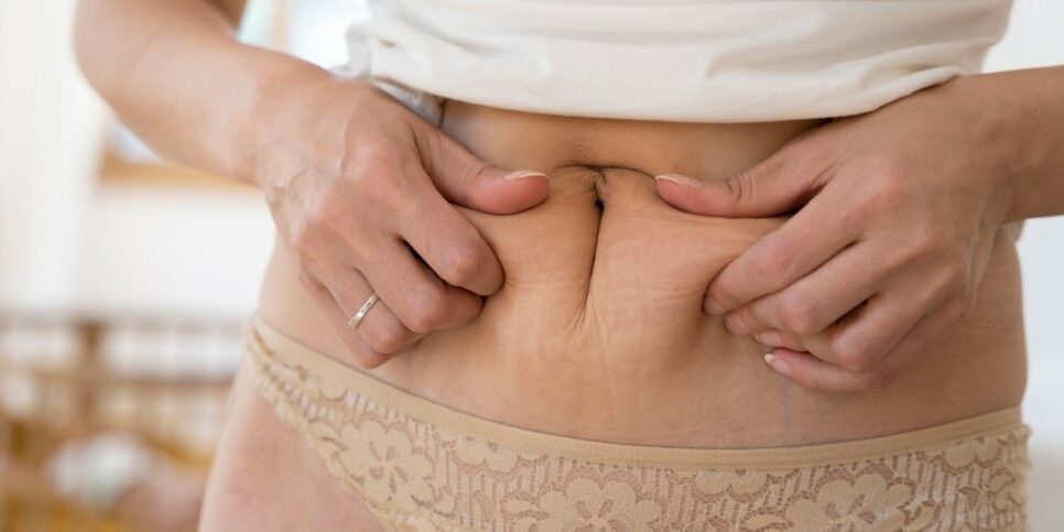 Aprenda a fazer um creme redutor caseiro que promete resultados