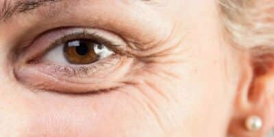 Rugas (Reprodução/Internet)