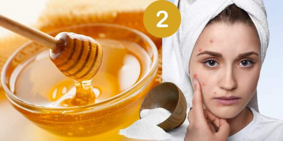 2 ingredientes exterminam cravos e espinhas (Foto: Reprodução / Canva)