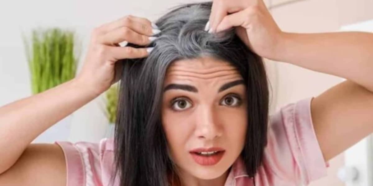 Descubra truque caseiro com batata com os brancos do cabelo (Foto: Reprodução/Internet)