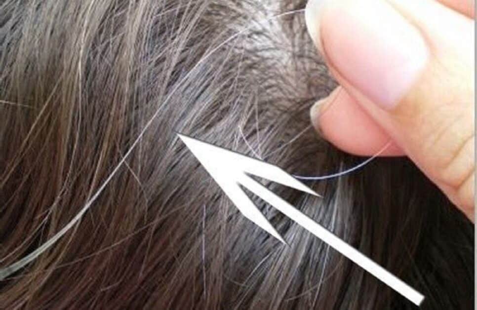 Arrancar um fio de cabelo branco (Foto: Reprodução/ Quora) Cabelos grisalhos