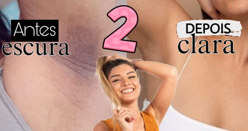 2 ingredientes e 15 minutos para solução que acaba com axilas escuras e manchadas; antes e depois (Fotos: Reprodução/ Internet/ FreePik/ Montagem)
