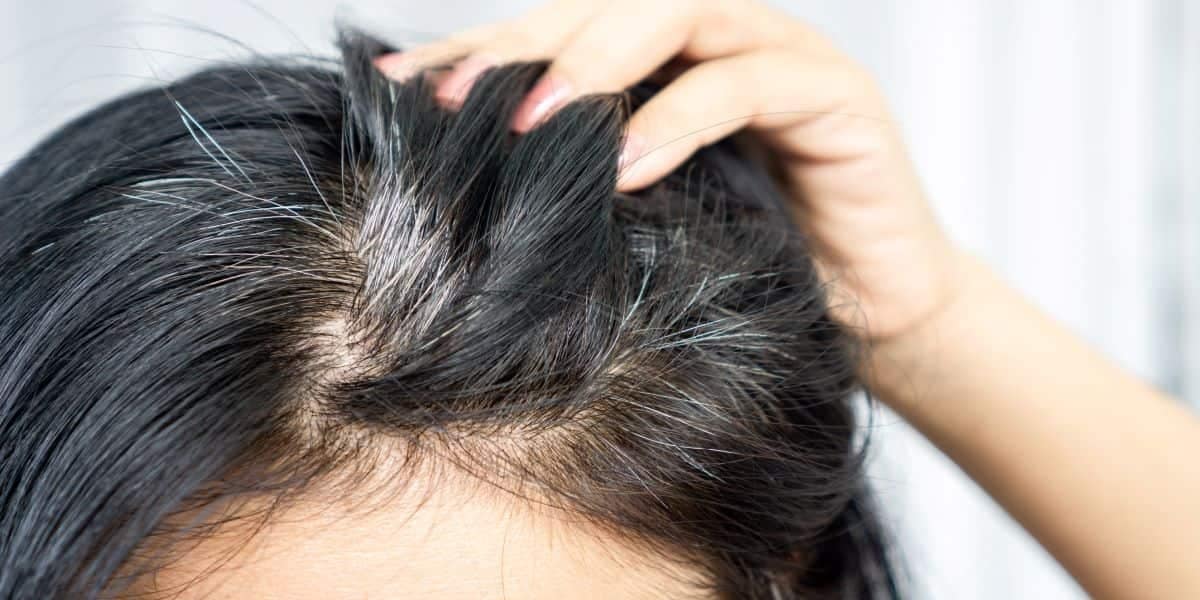 Aprenda a fazer em casa a mistura que pode salvar o seu cabelo (Foto: Reprodução/ Internet)