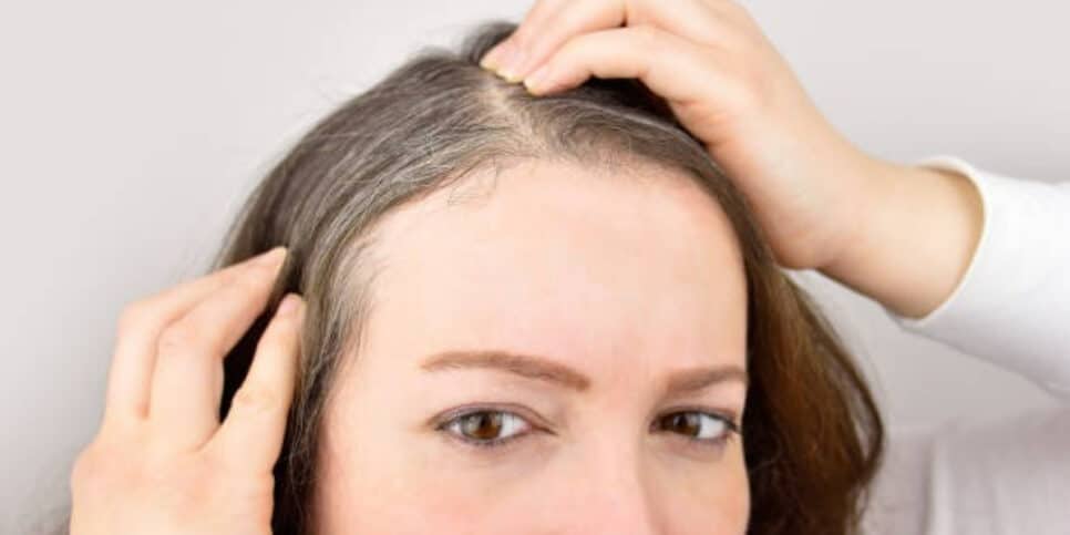 Não passe tinta! Veja como acabar com os fios brancos de cabelo (Foto: iStock/Manuel-F-O)