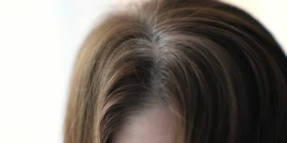 Veja o que pode estar acontecendo com o seu cabelo (Foto: iStock)