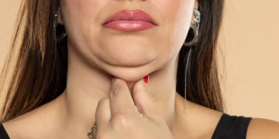 Autoestima: como acabar com a papada sem precisar de cirurgia (Foto: iStock/VladimirFLoyd)