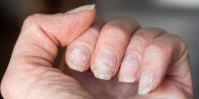 Imagem do post Unhas sem brilho e fracas? Veja como essas vitaminas podem mudar a sua vida