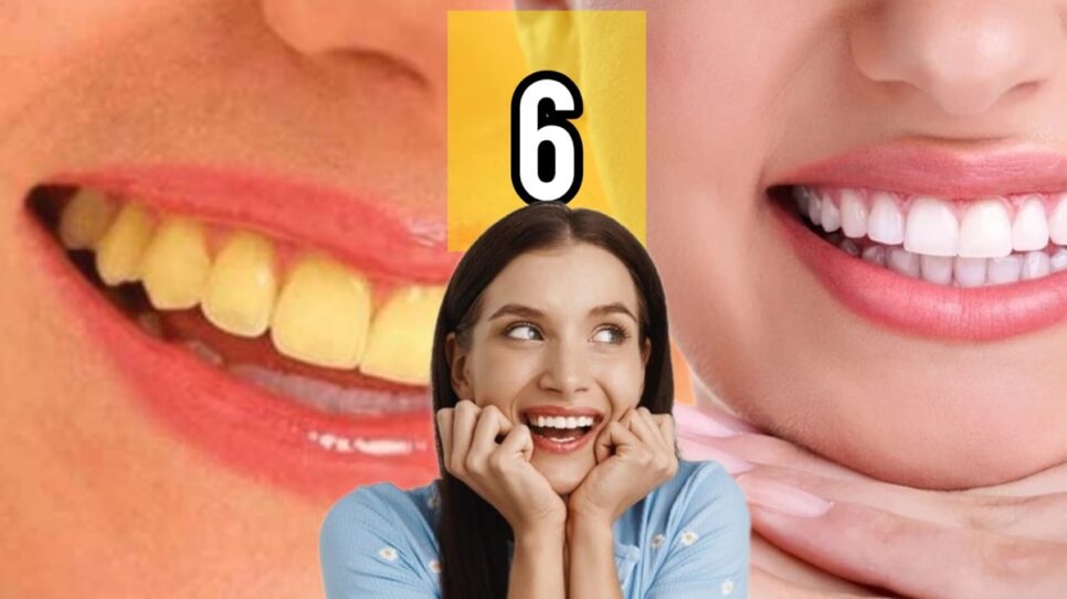 6 indicações para clarear os dentes amarelados em casa (Fotos: Reprodução/ Internet/ Freepik/ Montagem)