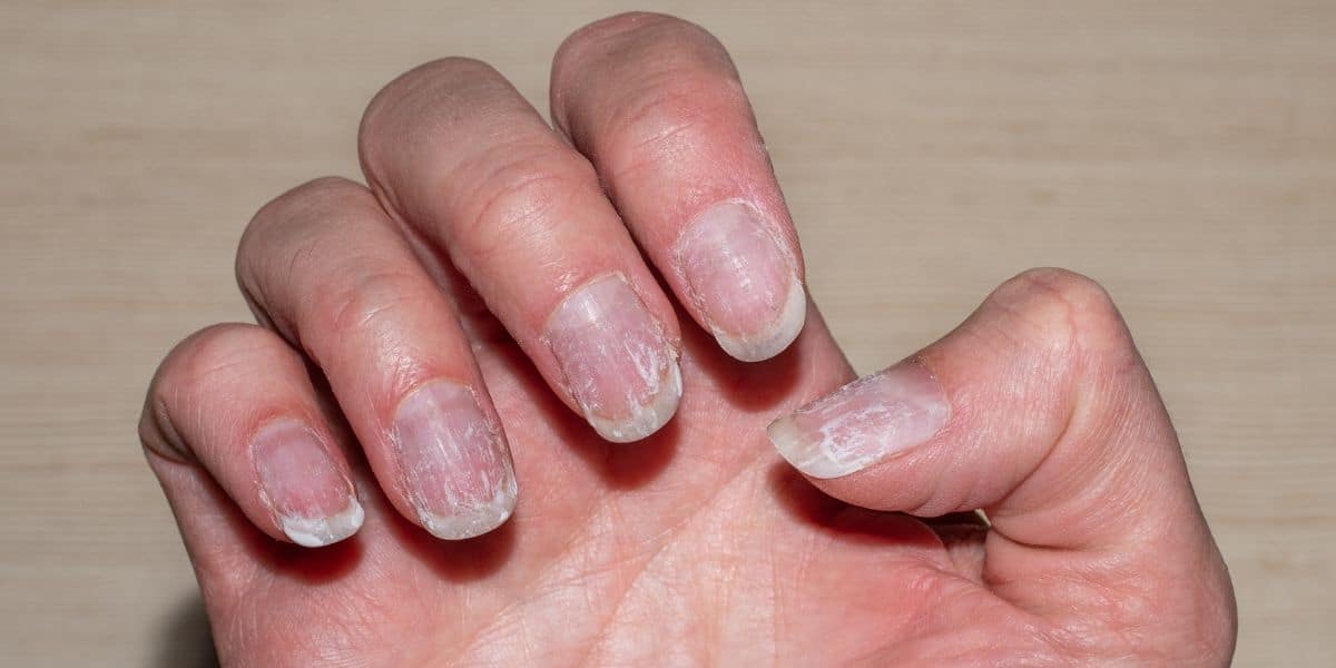 4 ingredientes de cozinha que vão ajudar as unhas quebradiças a ficar mais fortalecidas e revitalizadas (Imagem Reprodução Canva)