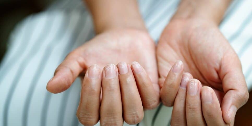 4 ingredientes de cozinha que vão ajudar as unhas quebradiças a ficar mais fortalecidas e revitalizadas (Imagem Reprodução Canva)
