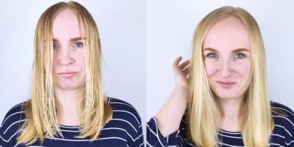 Veja a melhor forma de acabar com a oleosidade do seu cabelo (Foto: iStock)