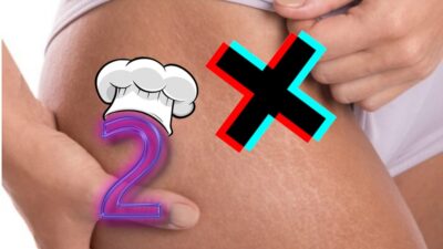 Imagem do post ESTRIAS derrubam sua AUTOESTIMA? Elimine essas marcas que INCOMODAM em receita com 2 ÍTENS de cozinha