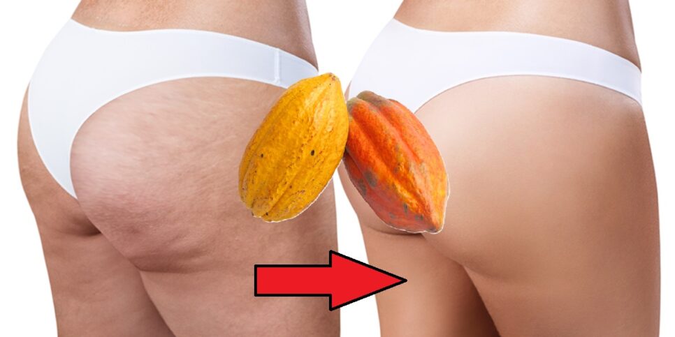 Massagem Antes e depois das celulites e cacau (Foto: Reprodução/ Formularium/ Colagem)
