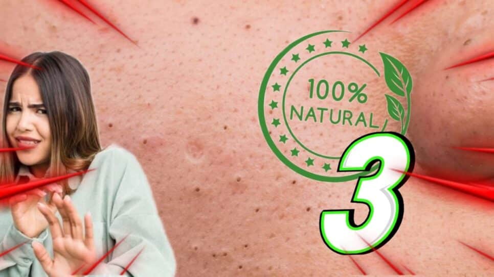 Chega de cravos no rosto! RECEITA 100% natural de 3 ingredientes (Fotos: Reprodução/ Internet/ Freepik/ Montagem)