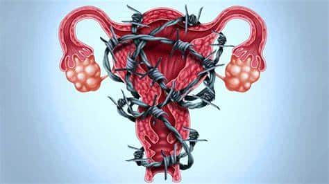 Saiba os sintomas da endometriose e seu tratamento adequado 