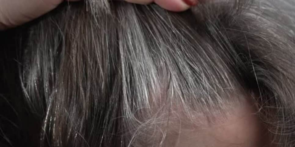 Sem grisalhos! Essa planta pode eliminar os brancos do cabelo (Foto: iStock)